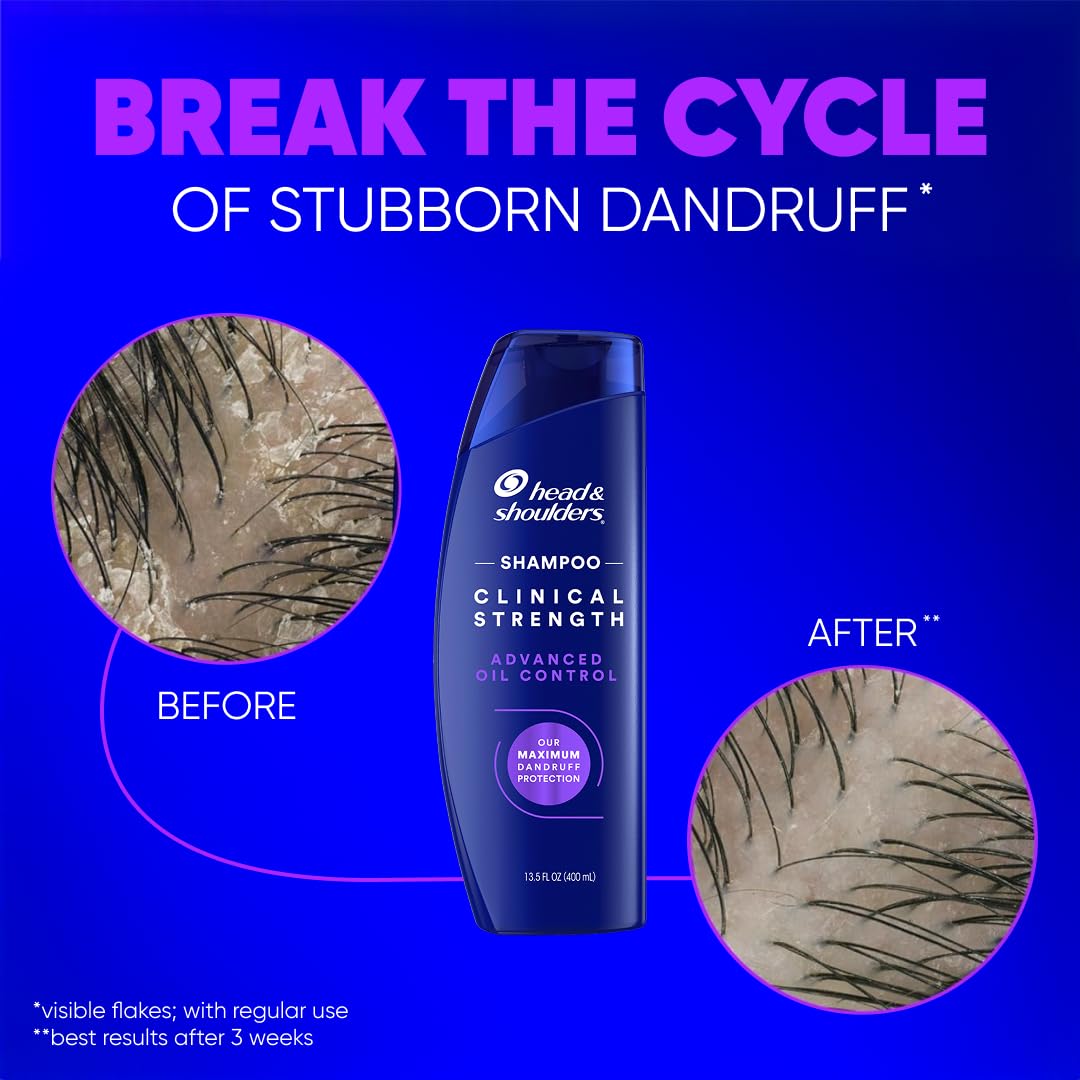 Head & Shoulders Clinical Strength Shampoo pouring into hand
