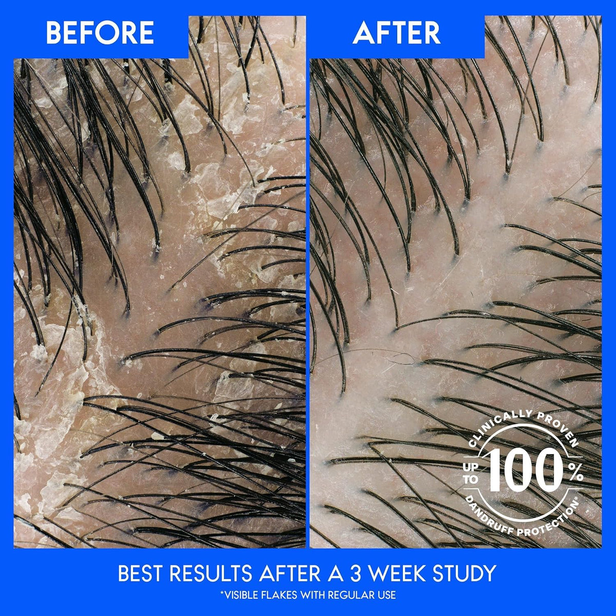 Head & Shoulders Dry Scalp Care Shampoo bottle back view