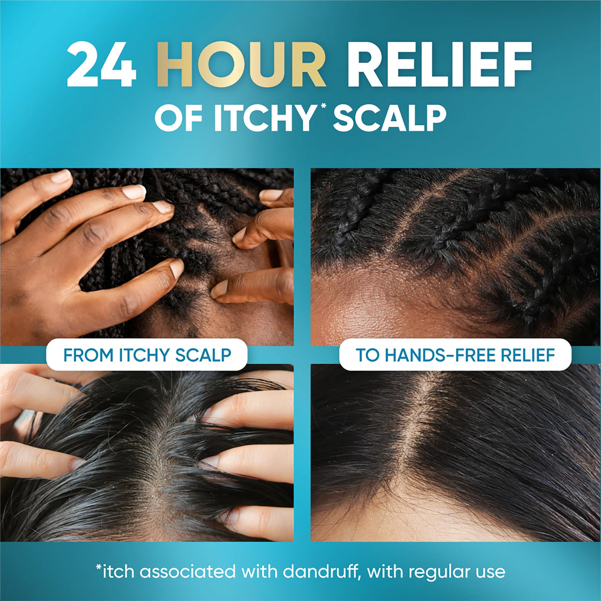 Head & Shoulders Royal Oils Instant Soothe Scalp Elixir with cap open