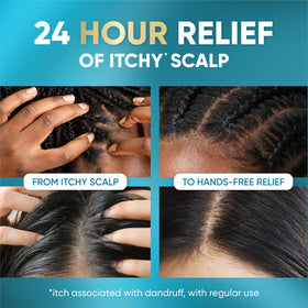 Head & Shoulders Royal Oils Instant Soothe Scalp Elixir with cap open