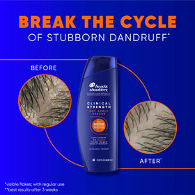 Head & Shoulders shampoo and conditioner packaging side view