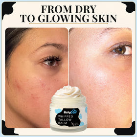 HolyCow Grass Fed Beef Tallow Moisturizer lifestyle scene