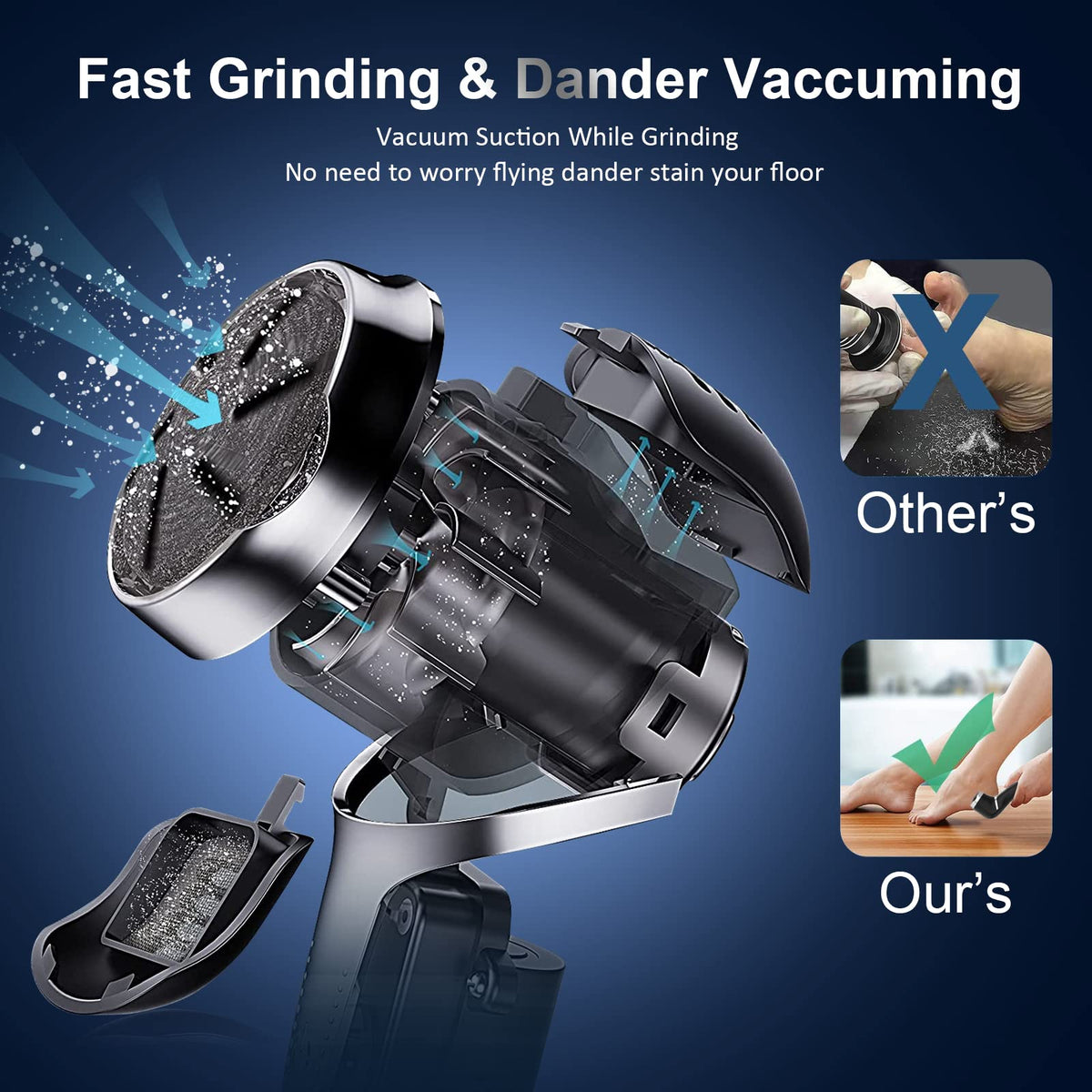 Hoxida callus remover showing 9 replaceable grinding heads