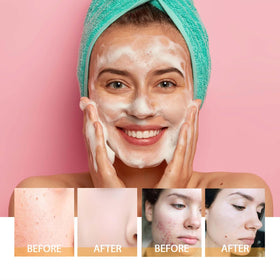 HOYGI Turmeric Face Wash foaming texture