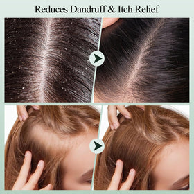 Ingredients list for VOERUY Scalp Scrub