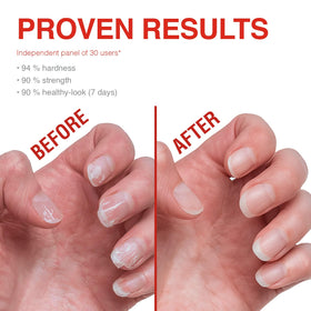 Ingredients list of Probelle Nail Strengthener