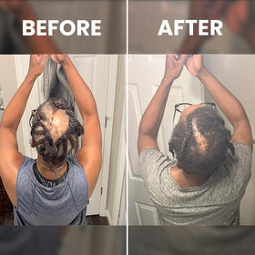 Ingredients list of RENNORA BEAUTY Hair Growth Serum