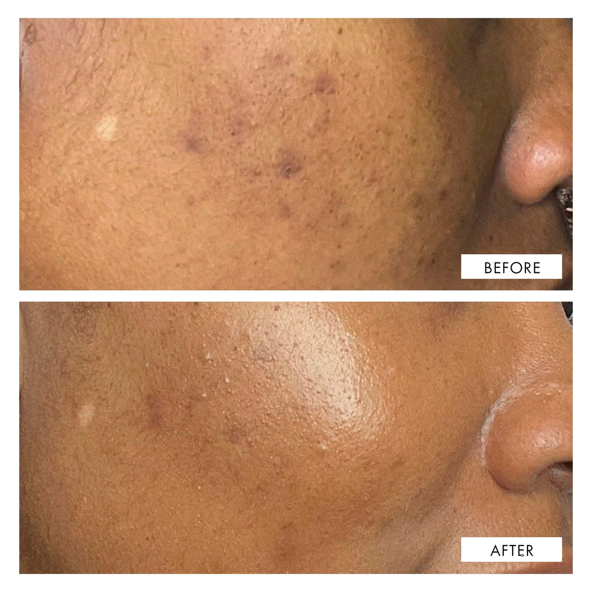 Ingredients of 111SKIN Dark Spot Correcting Serum