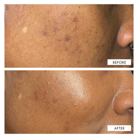 Ingredients of 111SKIN Dark Spot Correcting Serum