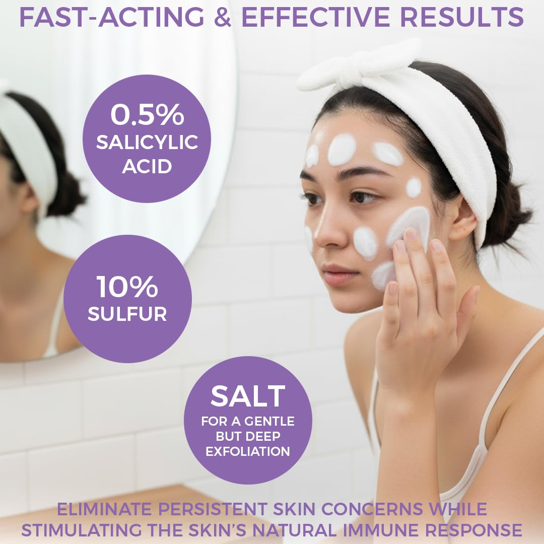 Ingredients of Angel's Skin Natural Wart Remover Soap