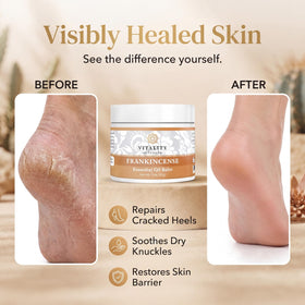 Ingredients of Vitality Frankincense Essential Oil Balm
