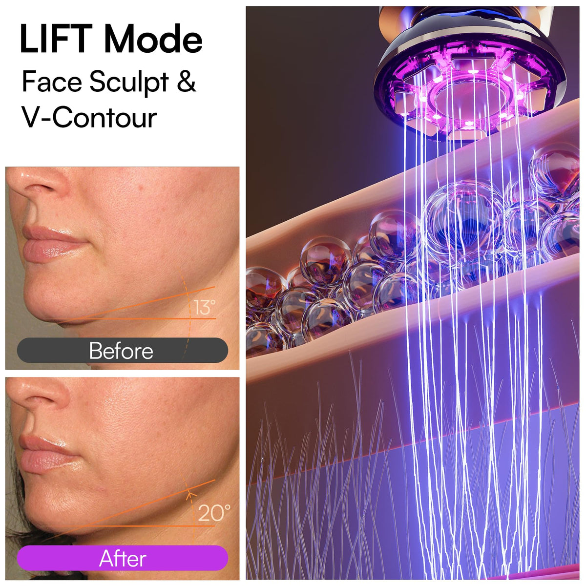 INIA Flare device demonstrating INFUSE mode
