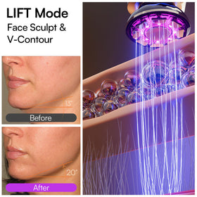 INIA Flare device demonstrating INFUSE mode