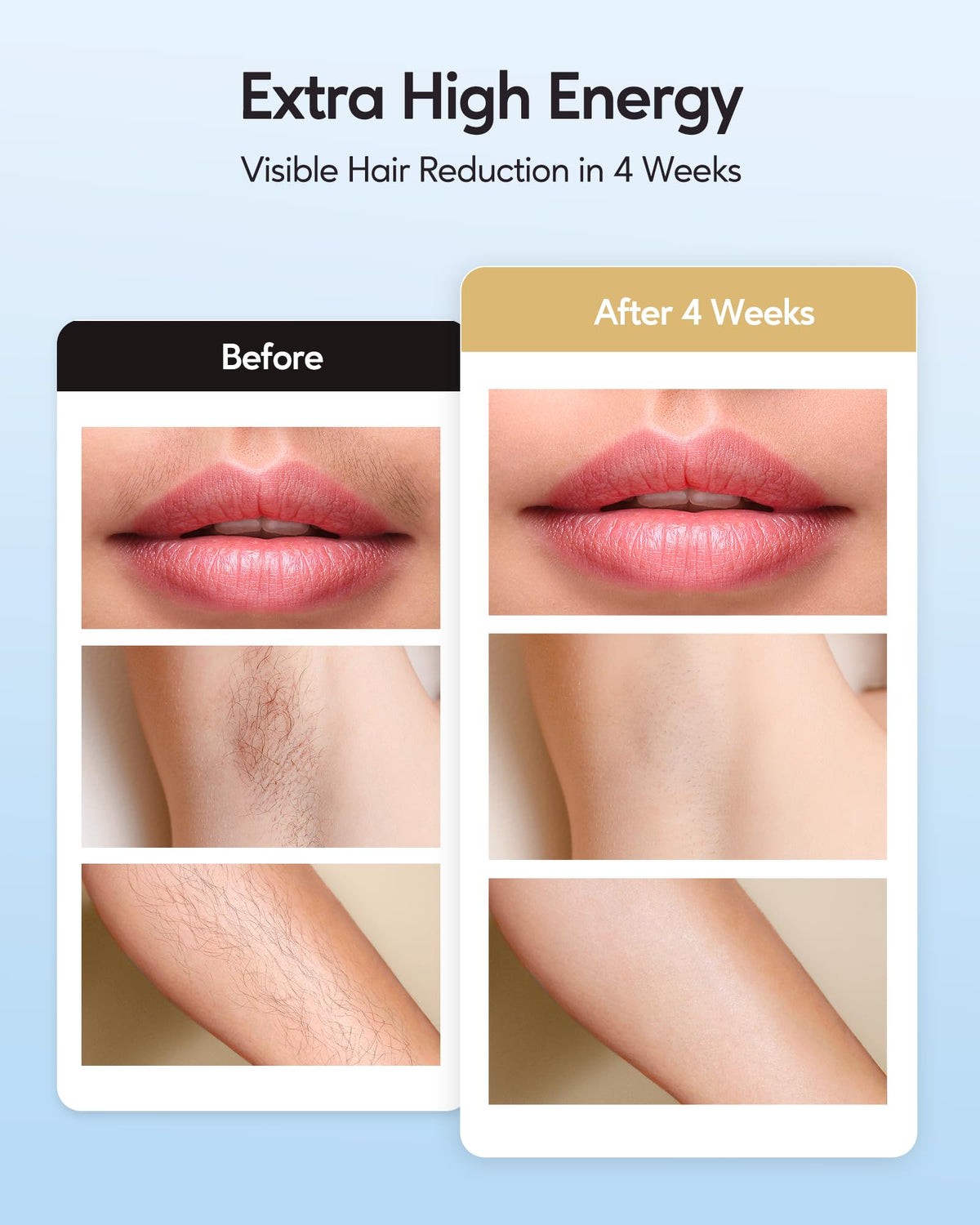 INNZA IPL Hair Removal Device in use on skin