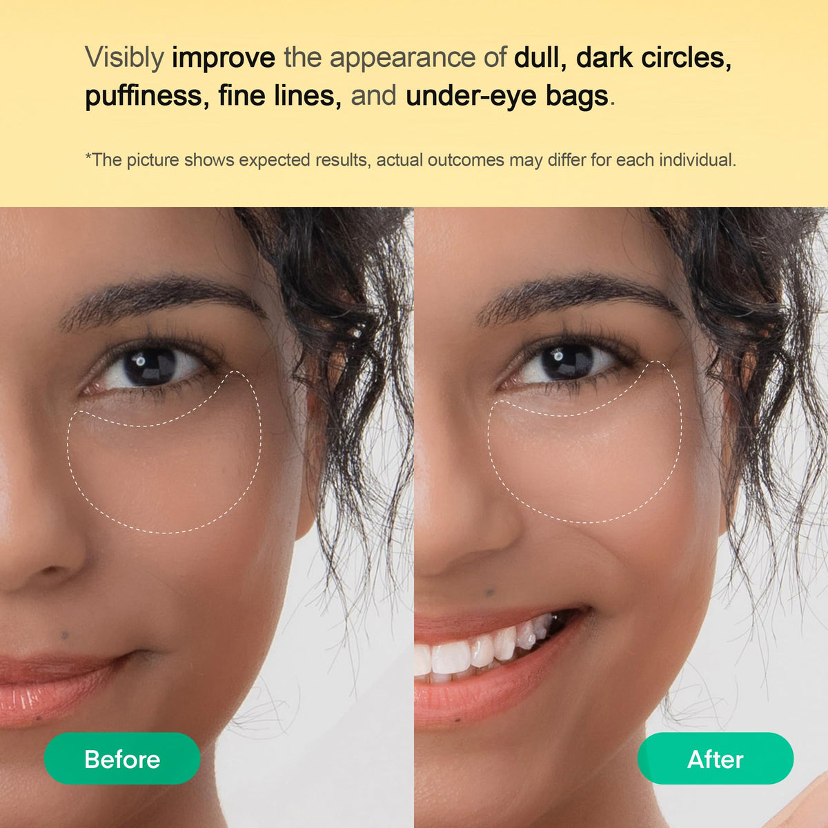 Inside view of TEREZ & HONOR Vitamin C Eye Patches container