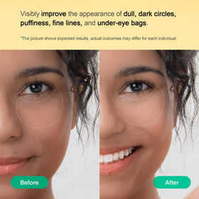 Inside view of TEREZ & HONOR Vitamin C Eye Patches container