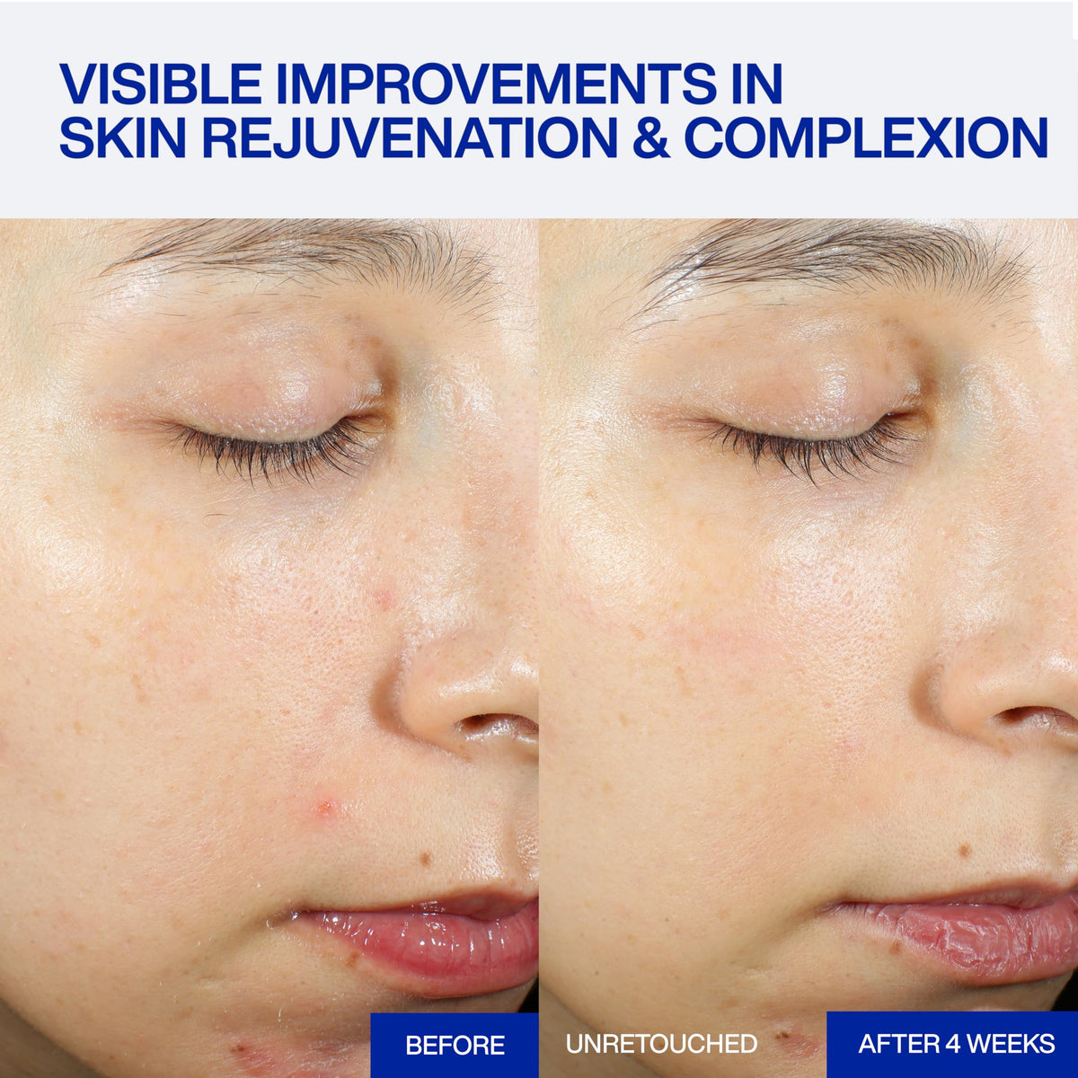 IOPE Expert PDRN Caffeine Shot Serum side view with pump applicator