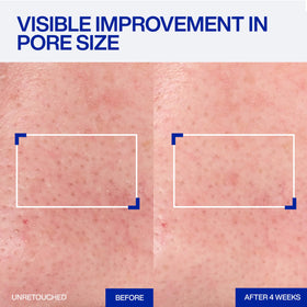 IOPE Expert Retinol RX 1% Super Bounce Serum application on skin