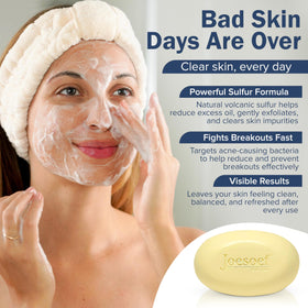 JOESOEF Anti-Acne Soap bar in a bathroom setting