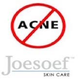 JOESOEF SKIN CARE Sulfur Acne Soap in bathroom setting