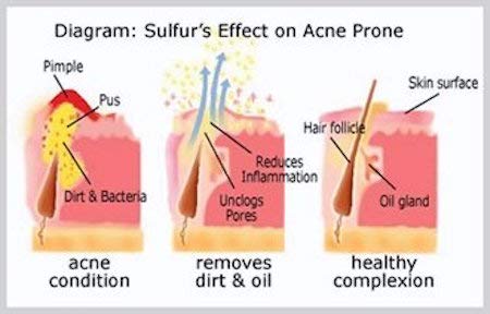 JOESOEF SKIN CARE Sulfur Soap lathering on hands