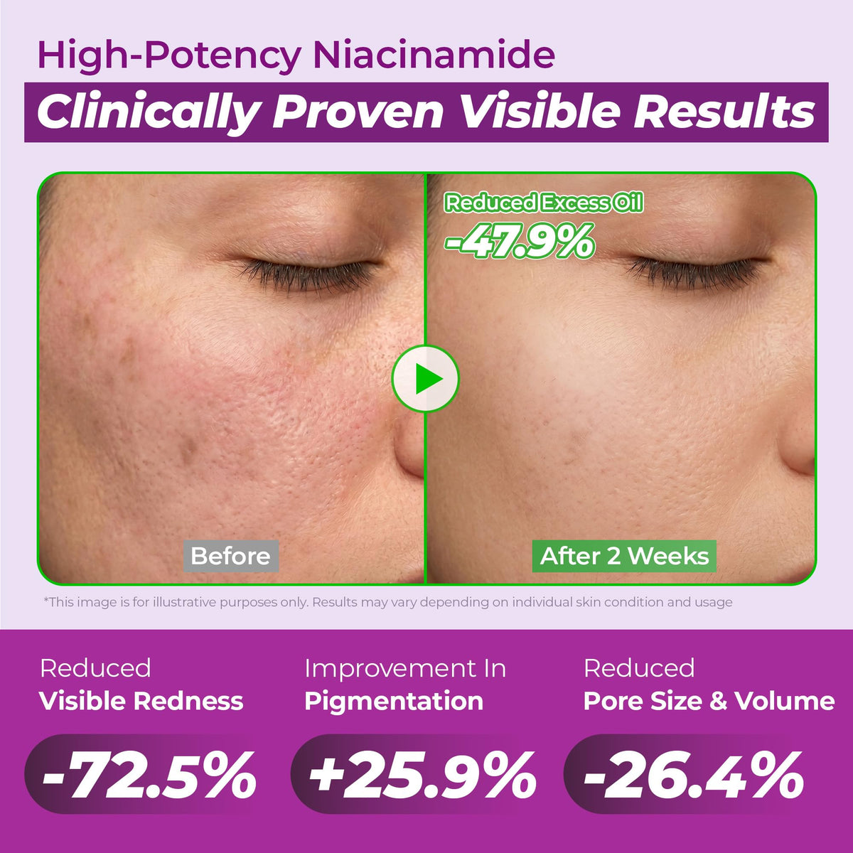 JUMISO 10% Niacinamide Dark Spot Serum packaging side view