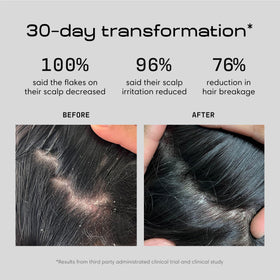 Jupiter Anti Dandruff Shampoo bottle with label