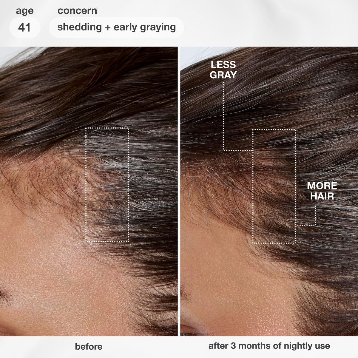 K18 FutureIQ Hair + Scalp Serum application on scalp