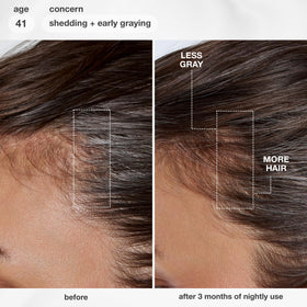 K18 FutureIQ Hair + Scalp Serum application on scalp