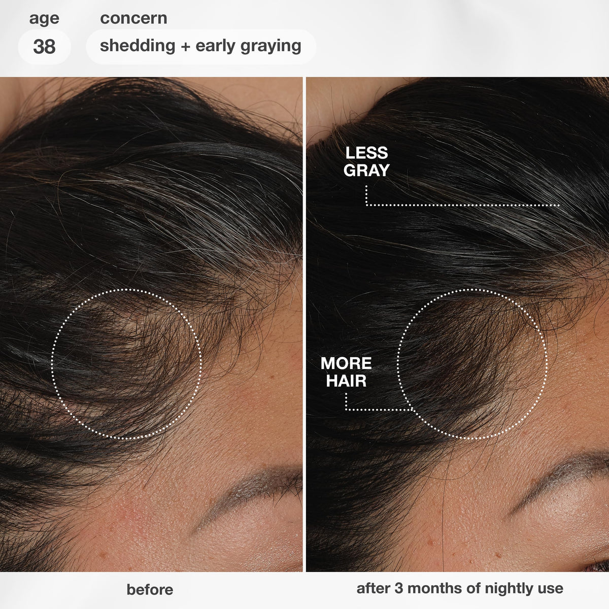K18 FutureIQ Hair + Scalp Serum packaging details