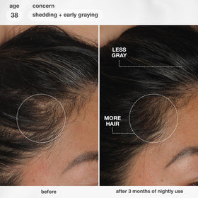 K18 FutureIQ Hair + Scalp Serum packaging details