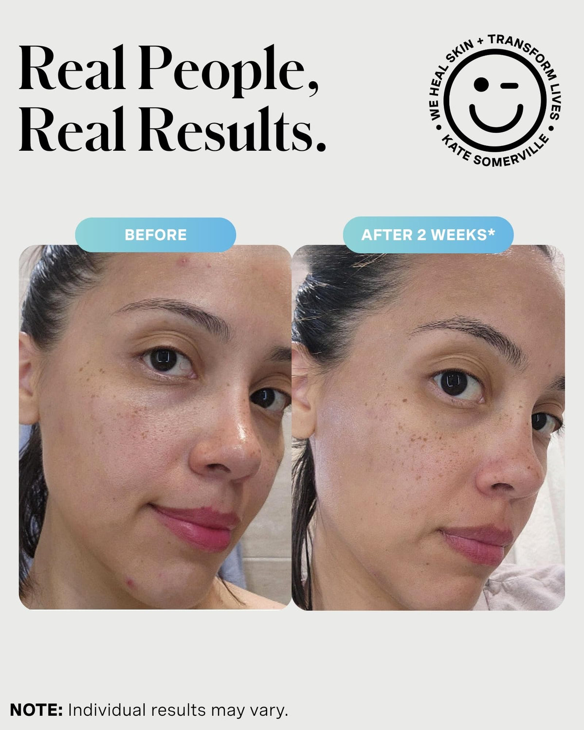 Kate Somerville EradiKate 3% Sulfur Cleanser packaging
