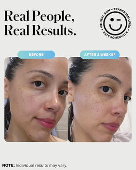 Kate Somerville EradiKate 3% Sulfur Cleanser packaging