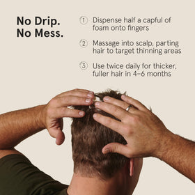 Keeps Minoxidil Foam 5% bottle with foam texture