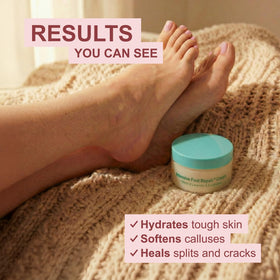 Kerasal Intensive Foot Repair Cream texture close-up