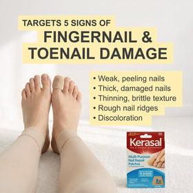 Kerasal nail patches applied to a fingernail