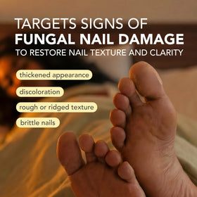 Kerasal Nighttime Nail Renewal Patches applied on nails