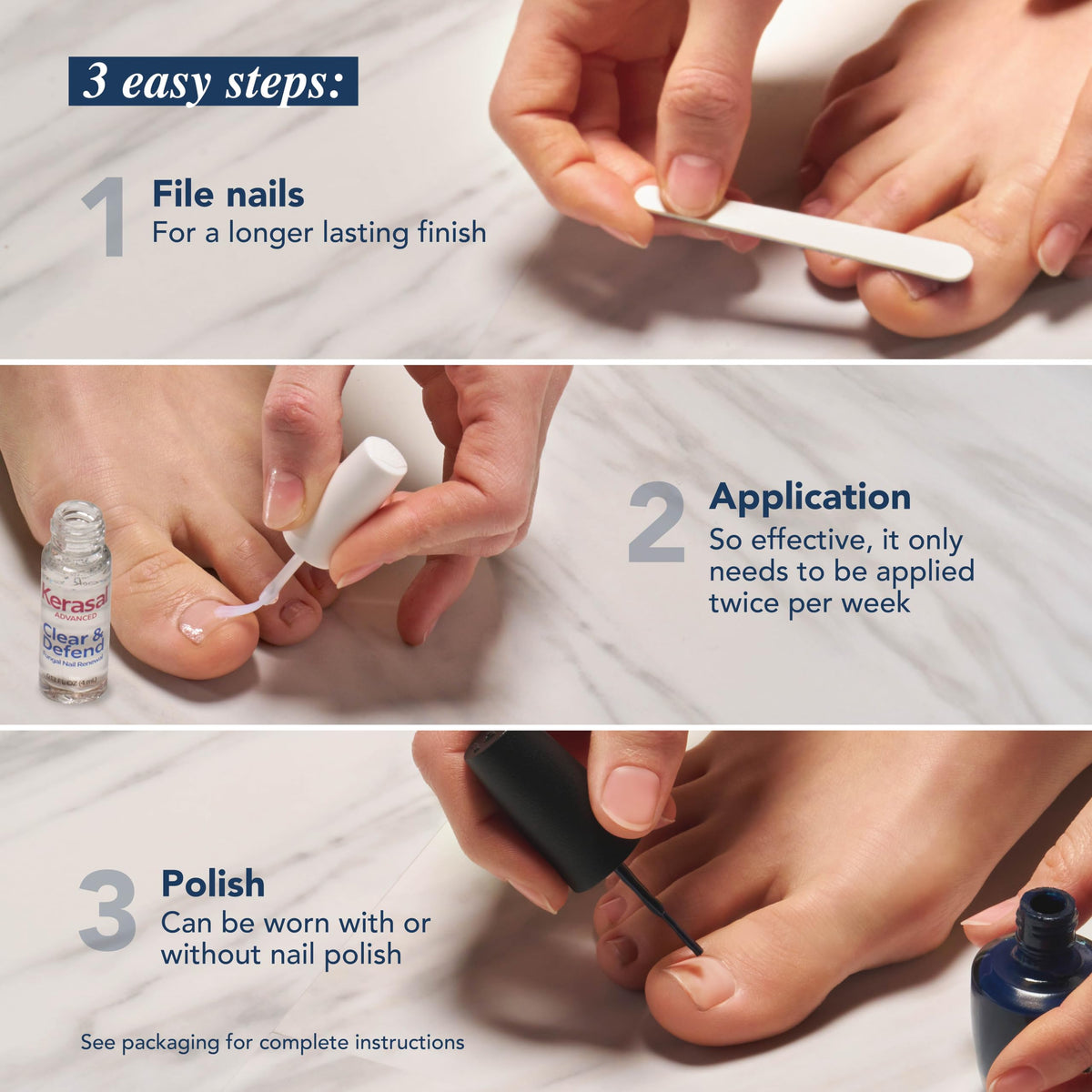Kerasal solution applied on nails with a shiny finish