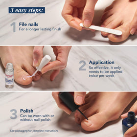 Kerasal solution applied on nails with a shiny finish