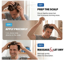 Kirkland Minoxidil 5% application instructions