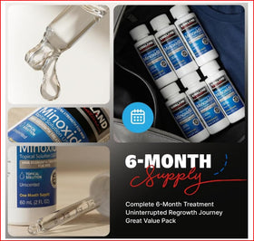 Kirkland Minoxidil 5% Topical Solution with measuring dropper