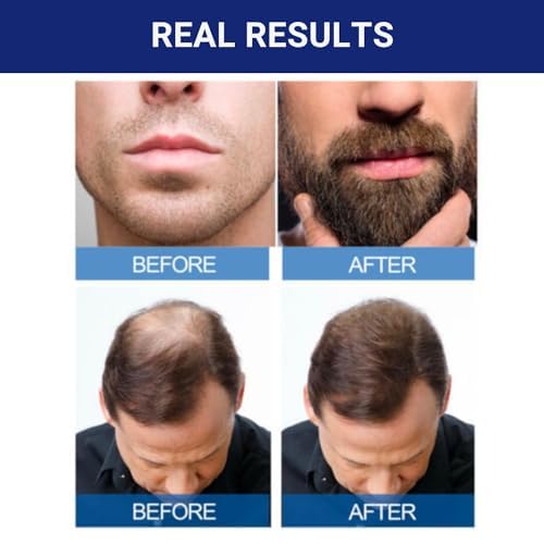 KIRKLAND Minoxidil for Men 5% bottle side view