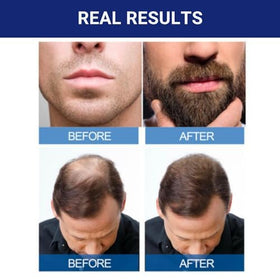 KIRKLAND Minoxidil for Men 5% bottle side view