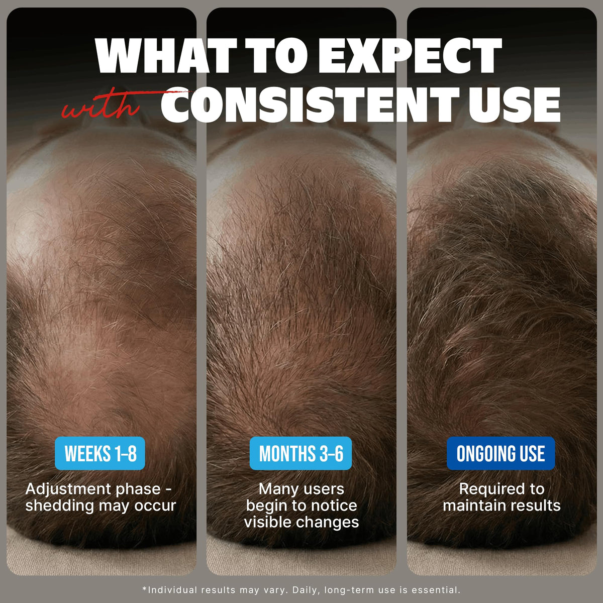 KIRKLAND Minoxidil Liquid packaging side view