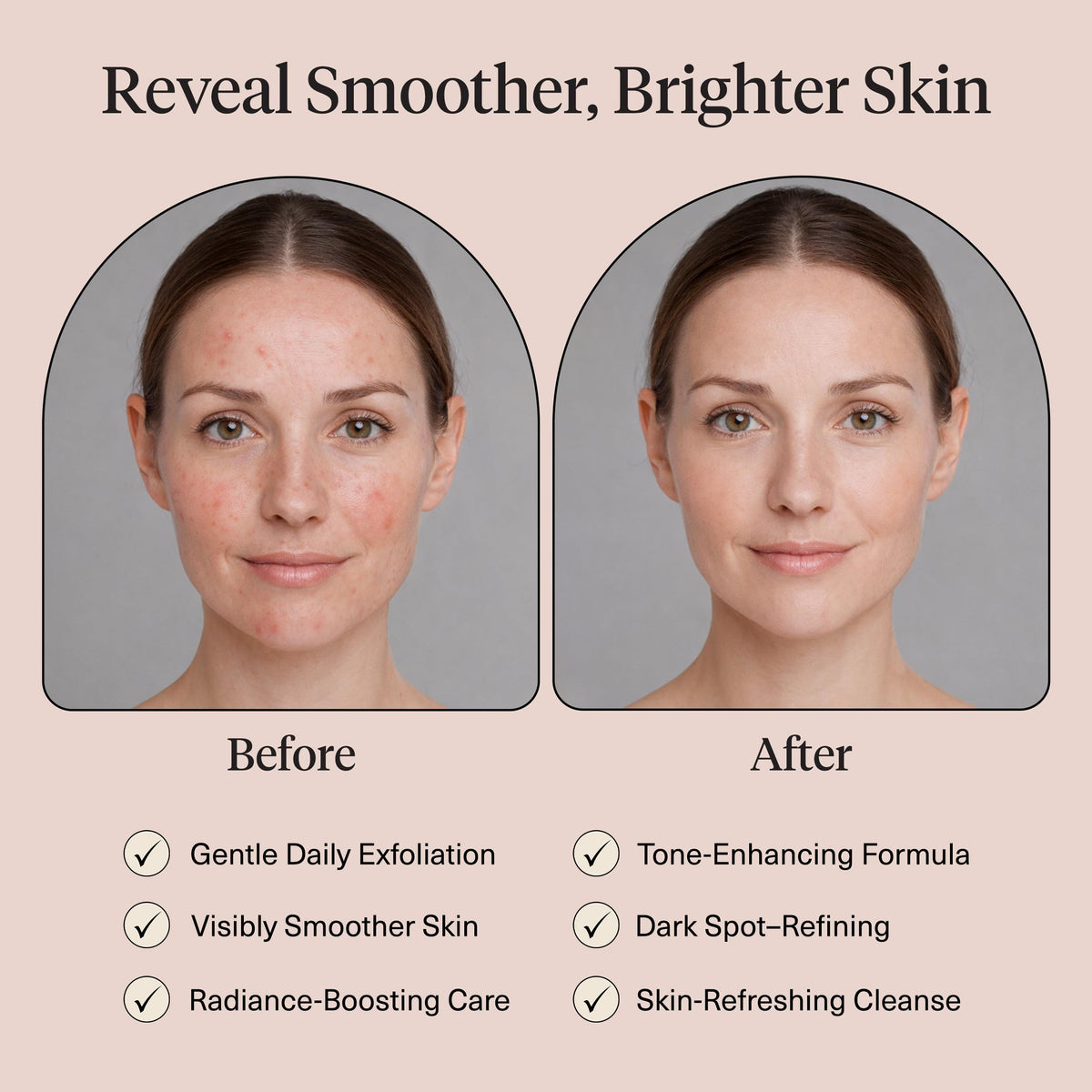 Kitsch Kojic Acid Cotton Pads with a background of skincare products