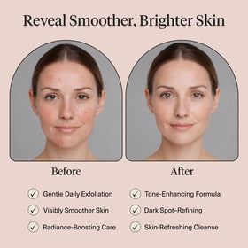 Kitsch Kojic Acid Cotton Pads with a background of skincare products