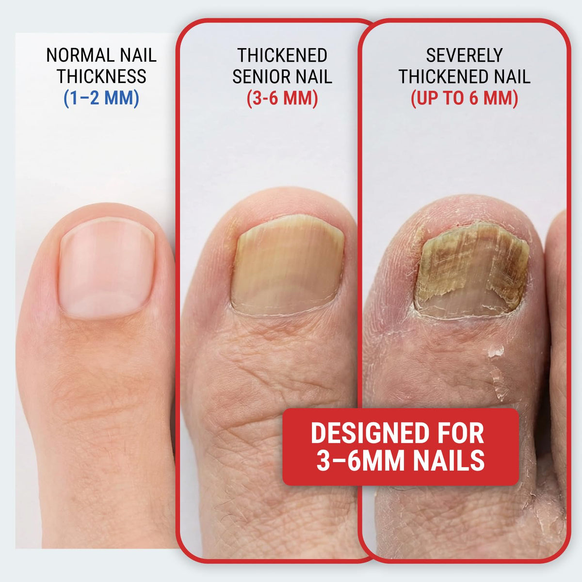 KLIPP Toenail Clippers in a hand for scale