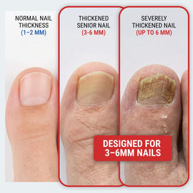 KLIPP Toenail Clippers in a hand for scale