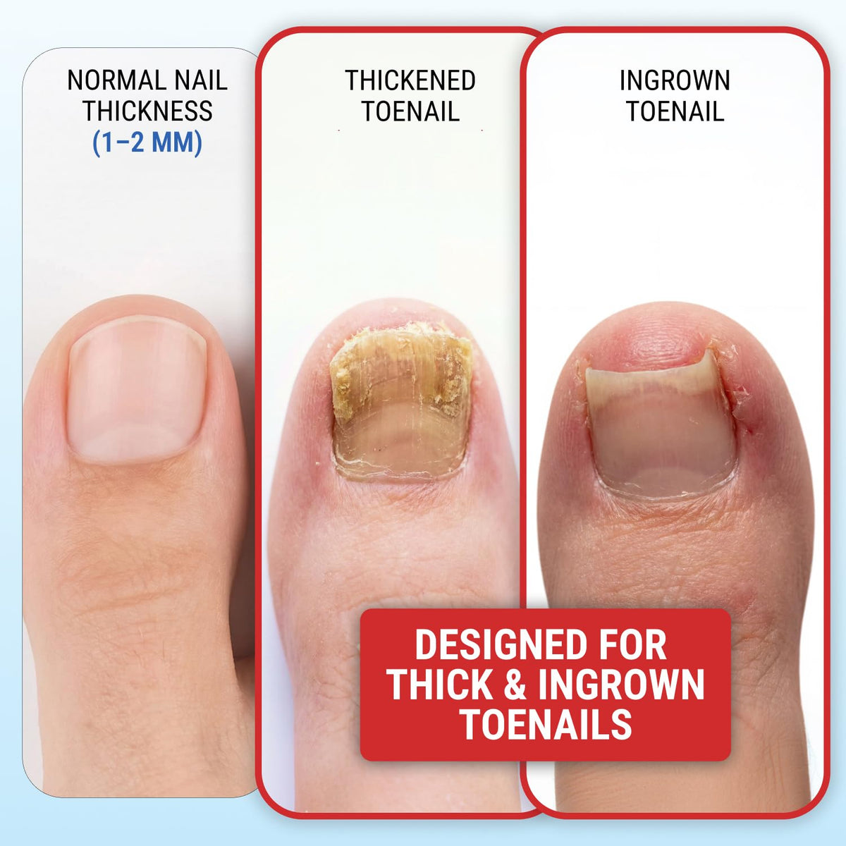 KLIPP toenail clippers in packaging with clear labeling