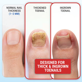 KLIPP toenail clippers in packaging with clear labeling